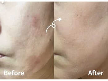サロンドミジュ(Salon de 美jyu)/プラチナ肌質改善