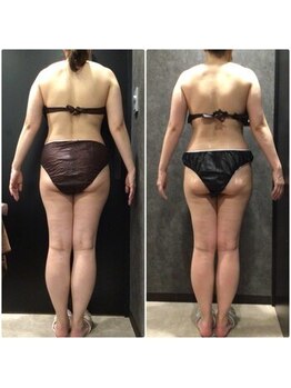 フローボディ 新山口店(flow BODY)/山口のエステはflow BODY