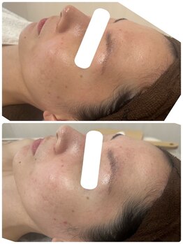 ムー(mu)/ララピール/トーンアップ/ハリ