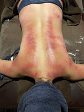 ビーアンドアイ シズオカテン レディース(B＆I SHIZUOKA)/ファシアリリース！ファシアケア