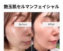 フェイスプラスリフ(FACE+RiF)