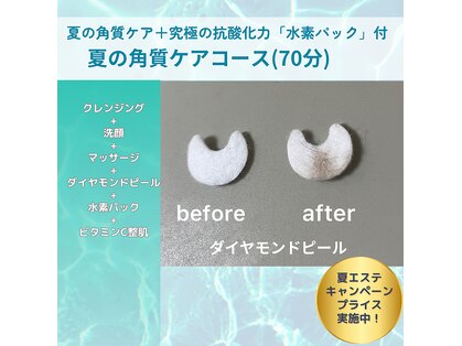 アマテ(Amate)の写真