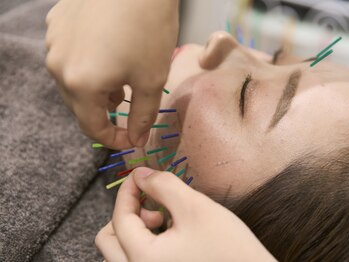 ヴィーライン 上大岡(VeLine)の写真/芸能人御用達・著名人も多数ご来院の美容鍼灸サロンが、ついに上大岡に！実績多数の本格技術をご提供◎