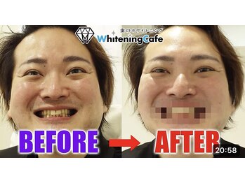ホワイトニングカフェ 秋葉原店(WhiteningCafe)/◎メディア紹介