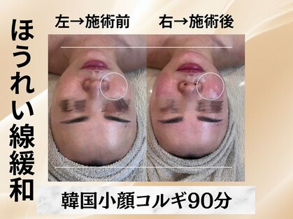 イヨヨ(iyoyo)の写真