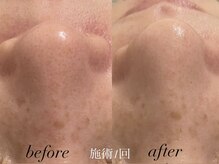 リスポアラボ(LIS PORE.LAB)/