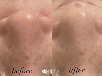 リスポアラボ(LIS PORE.LAB)/