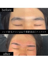 ユー 千葉駅前店(you)/ビフォ－アフター写真