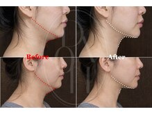 多穏スキンケア(skin care)