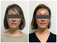 フィシス/人気NO1メニュー