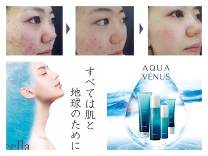 プリベンティブ ビューティー ティップス(Preventive Beauty Tips)の写真