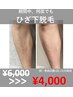【男性】両ひざ下脱毛(ひざ,足含む)　¥6000→¥4000