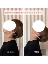 カルラ(KARURA)/肩こり/頭痛が多い方は動かない