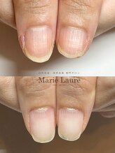 マリーロール 淀屋橋本店(Marie Laure)/自爪育成/深爪矯正/ネイルケア