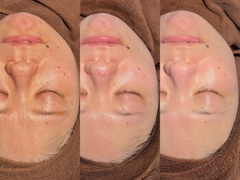 ルーナジェーナ(Luna llena)/