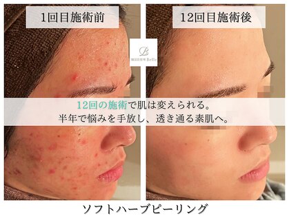 ベル 堀江(Belle)の写真