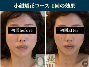 キュープ 表参道店(Qpu)/継続が「小顔」と「美」をつくる