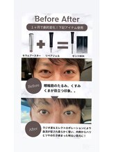 ドマイロ鍼灸院(Domairo鍼灸院)/美容鍼に目元のクマケアをプラス