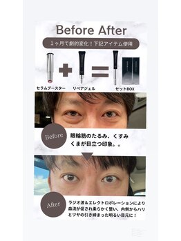 ドマイロ鍼灸院(Domairo鍼灸院)/美容鍼に目元のクマケアをプラス