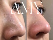 エイミー(Amy)/-【毛穴トリートメント】-