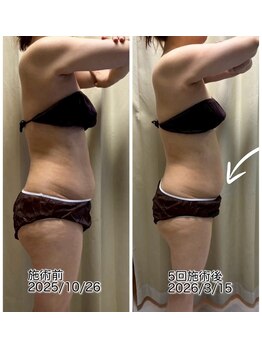 クールスパ(COOL SPA)/【100カップチャレンジ経過】