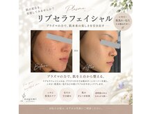 なごみの雰囲気(お肌お悩み改善)