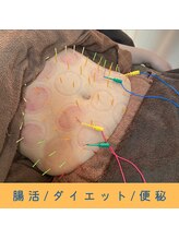 いつつのき/美腸鍼