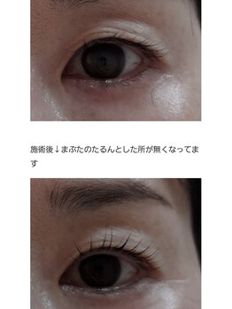 アロマスイーツ(AromaSweets)/まつげパーマ/まつ毛パーマ