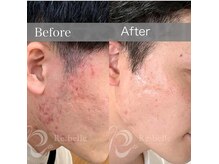 ビスキン(BeSkin)の雰囲気（完全個室。男性のお客様も気軽に来店可能！フェイシャルコース）