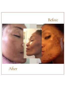 ココロ(COCORO)/細胞にアプローチ!『セルラム』