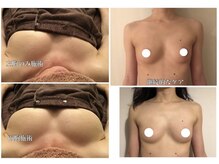 シンデレラ(Cinderella)の雰囲気（“満足度No.2”体重を落とす【別人級/ダイエットプログラム】）