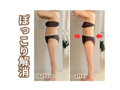 ヒールプラス(heal+)の写真