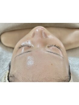 毛穴ケアをしたい