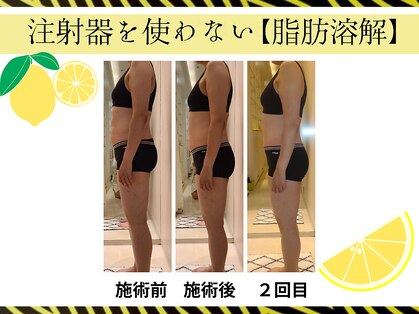 クリニカルエステ/イーズ パークプレイス大分店の写真