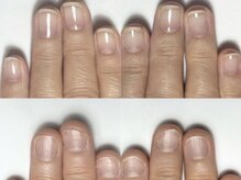 サロンミー(salon Mii)/自爪育成