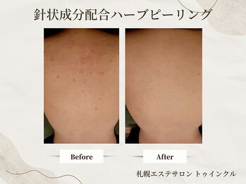 プライベートエステサロン トゥインクル/出たり消えたりを繰り返す方に