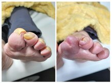 フレッシュフット(FreshFoot)/足のトラブルお任せください