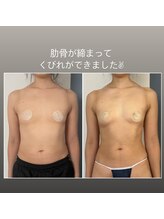 スカイ(sky)/美バスト＆美姿勢