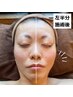 たるみ引締め美小顔術☆たるみケア・引締め・ハリ肌効果☆半額クーポン6600円
