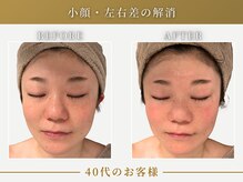 リムーン(REMOON.)/施術後の効果★40代のお客様