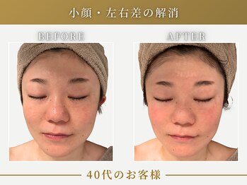 リムーン(REMOON.)/施術後の効果★40代のお客様