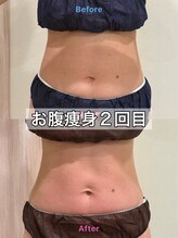 ルポアン(Repos an)/上半身痩身