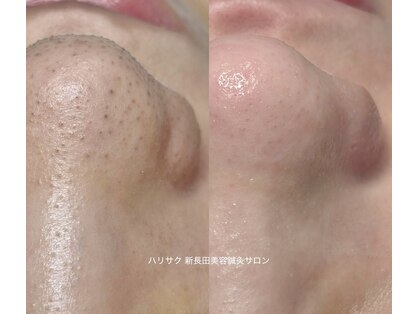 ハリサクの写真