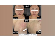 サロン ド ビューティージュエル(salon de beauty JEWEL)