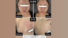 サロン ド ビューティージュエル(salon de beauty JEWEL)