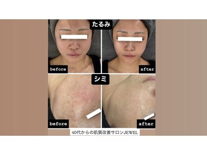 サロン ド ビューティージュエル(salon de beauty JEWEL)の写真