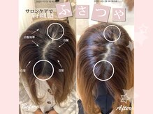 ディアメ(Diame)/スカルプケア