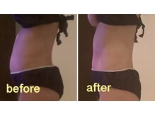 クレアボディ(CREA BODY)/お腹