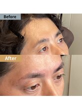 眉毛ハウス 吉祥寺店(眉毛HOUSE)/お客様の施術例(吉祥寺/東京)