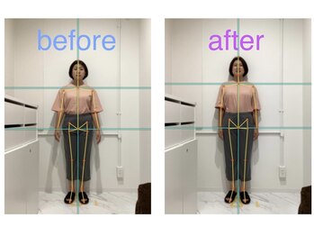 レピア 夙川本店(Lepia)/骨盤と肩のラインが整いました♪